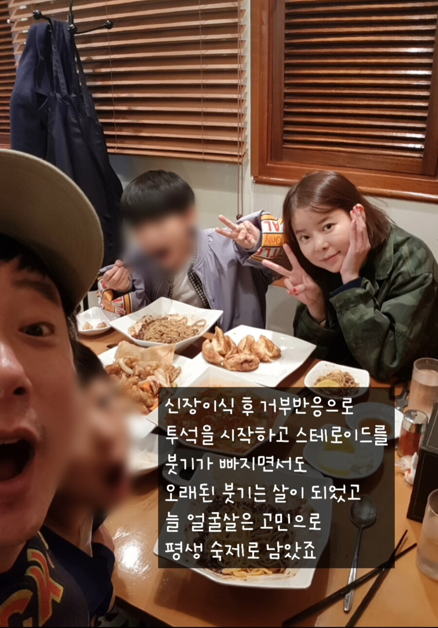 '이수근♥' 박지연, 신장이식 그 후 "부각용 부기에 필러, 흘러내려"