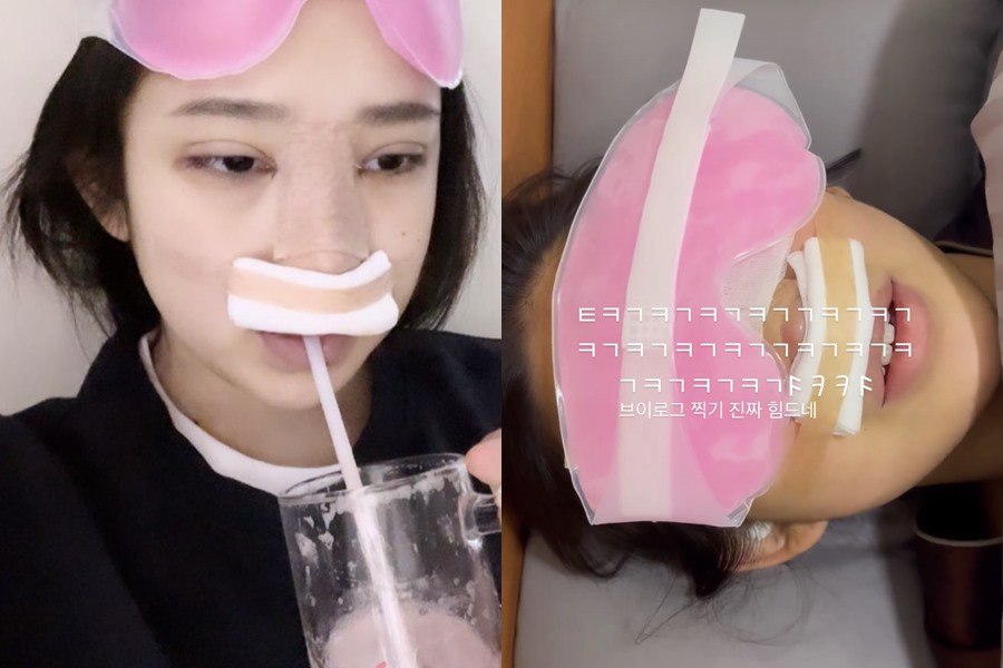 '故최진실 딸' 최준희, 눈·코 재수술 받고 후회 "오늘 한 나는 바보"