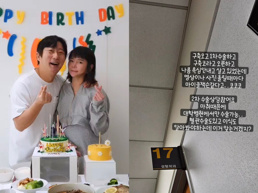 '이수근♥' 박지연, 코 성형 부작용  "마이클 잭슨 같다고"