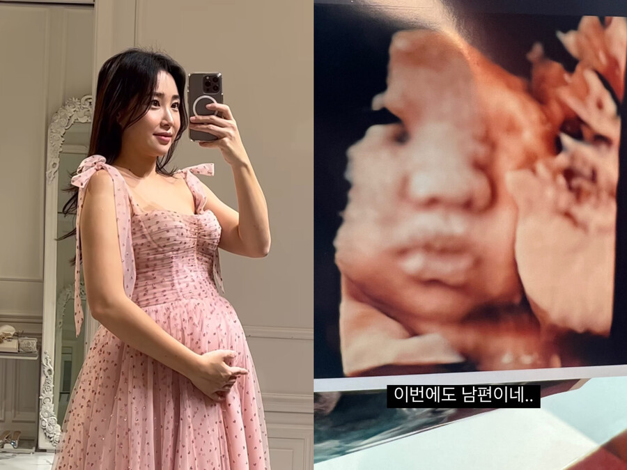 최희, 둘째 초음파 깜짝 공개 "이번에도 남편이네"