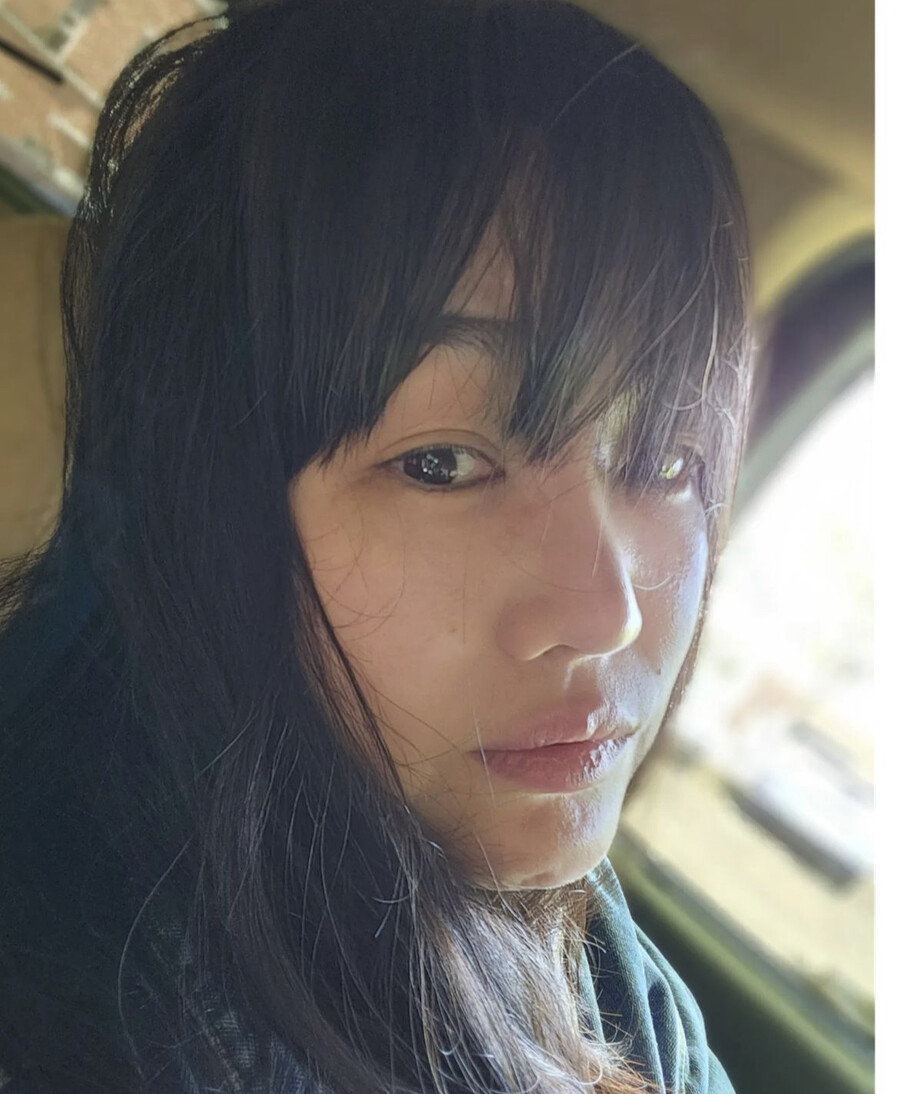 '설암 투병' 정미애, 고통에 악플에 울었나 "눈도 마음도 팅팅"