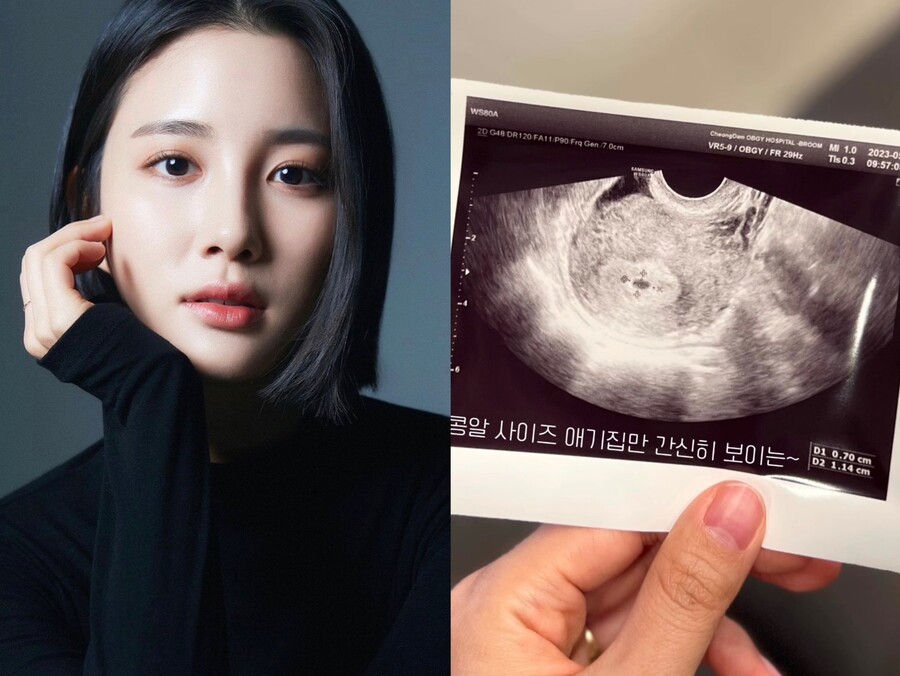 타히티 출신 지수, 결혼 2년 만에 임신 "일상생활 힘들어"