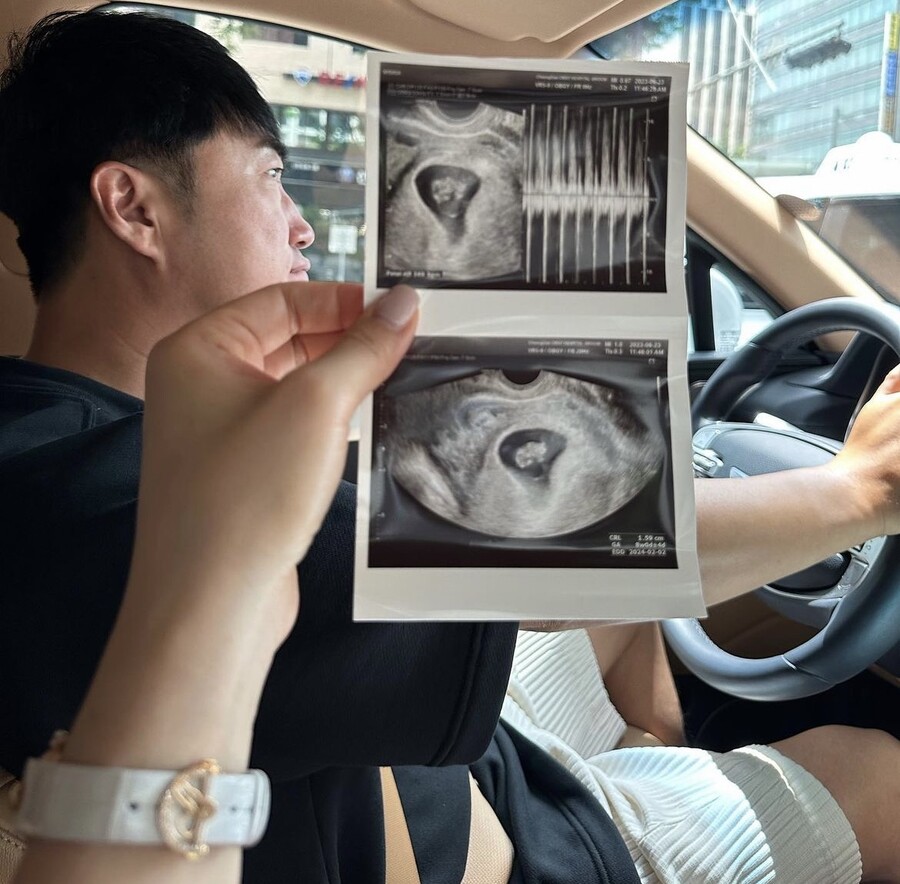 ▲ 장동민. 출처| 주유진 SNS