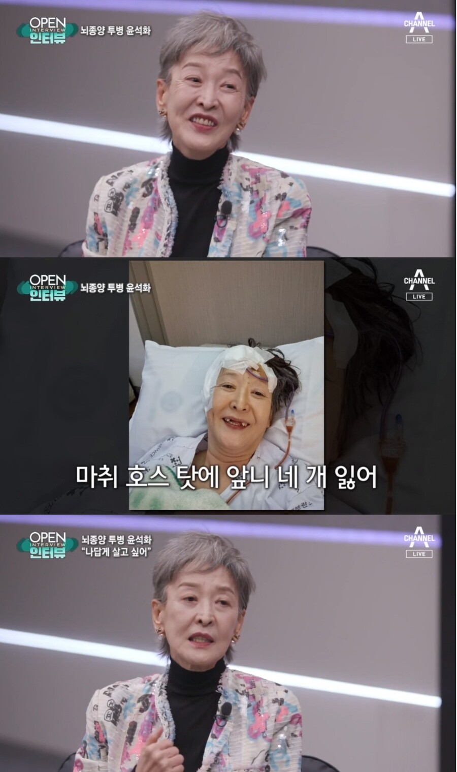 '뇌종양' 윤석화 "앞니 4개 잃고 체중 36kg로→항암치료 중단…암만 빼고 건강해"