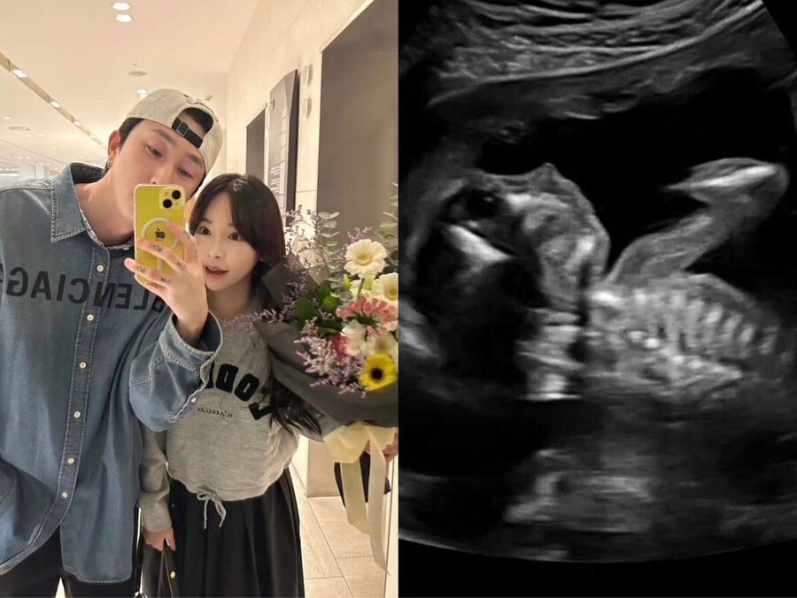 ▲ 출처| 슬리피 SNS
