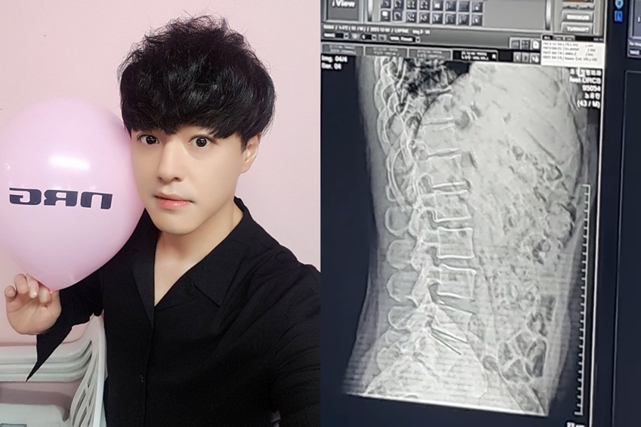 NRG 노유민, 딸과 놀다 호흡곤란+혼절 '충격 근황'…"심각한 척추 손상 無"