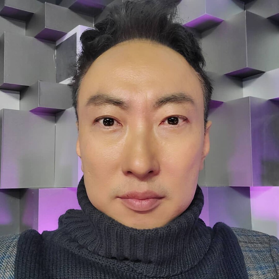 박명수, 쌍꺼풀→지방재배치…이번엔 "안검하수 수술계획"