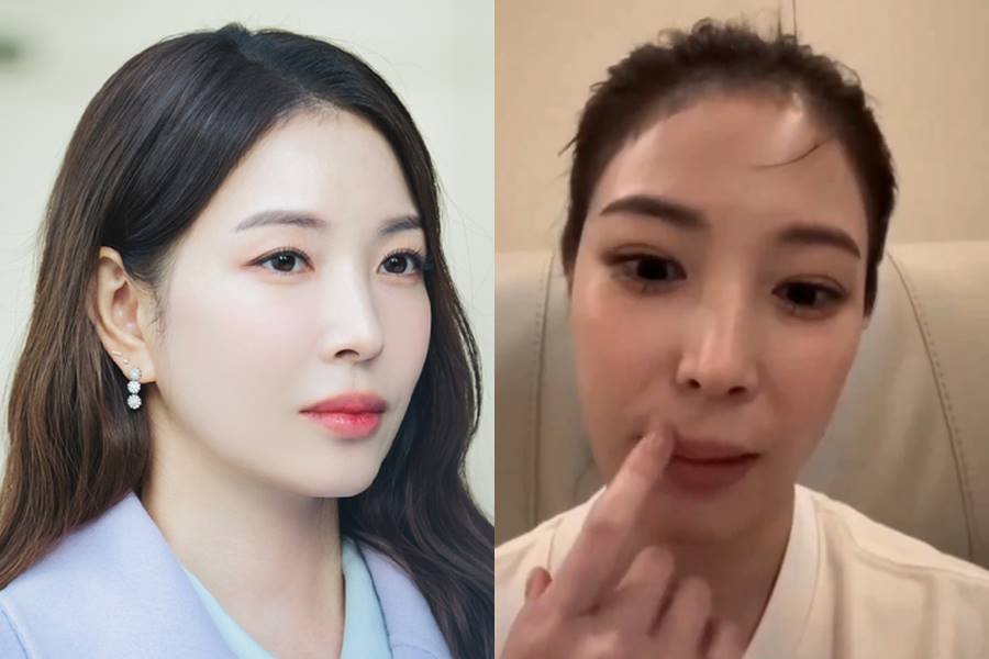 "내 입술 멀쩡해…걱정 NO" 보아, '내남결' 외모 지적에 쿨한 대응