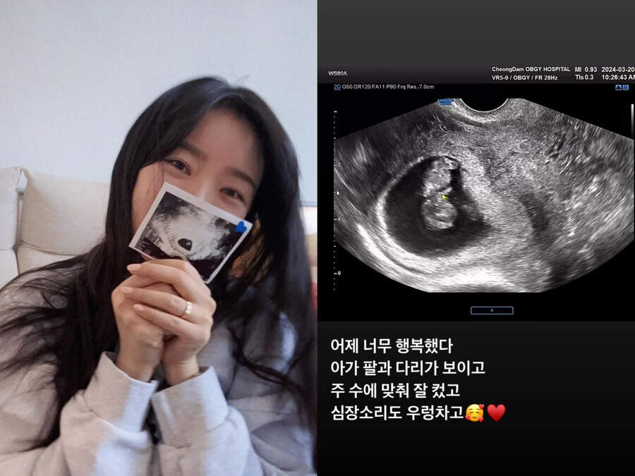 '4년 만의 임신' 배슬기 "우렁찬 심장 소리→팔다리" 2세 초음파 공개