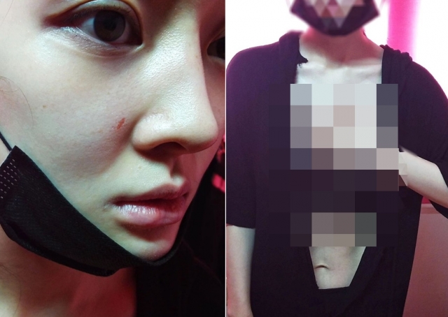 ▲ 출처|아름 SNS