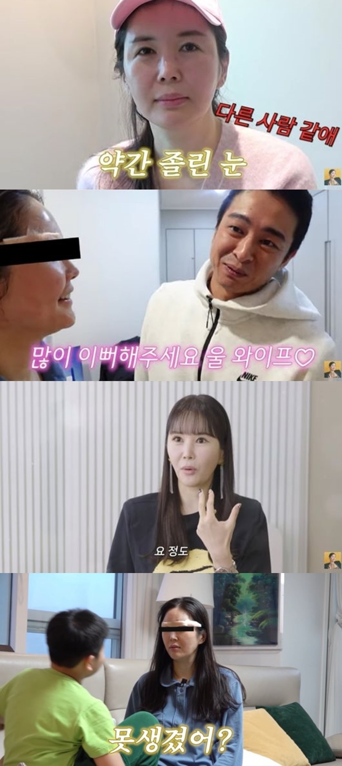 장영란, 6번째 눈 성형에 행복..반대했던 ♥남편·자녀들 "무섭고 위화감"(A급장영란)