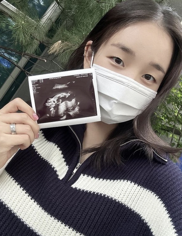 백아연, '용띠맘' 된다…"딸 임신 5개월, 母 된다는 것 멋져"[전문]