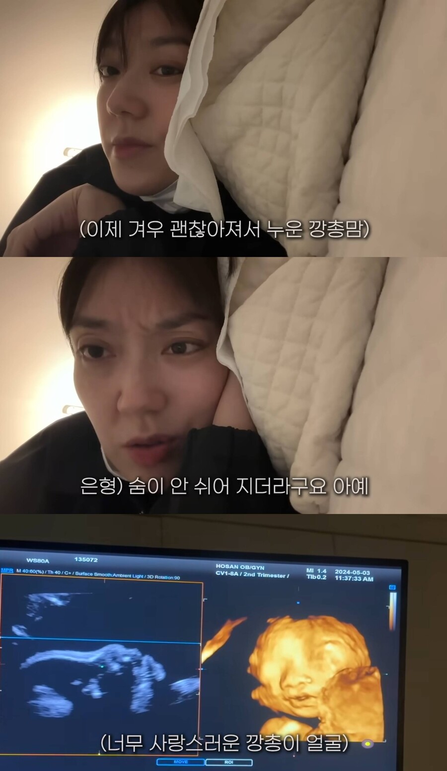 '강재준♥' 이은형, 임당 검사 중 저혈당 "숨이 안 쉬어져…죽다 살아나"