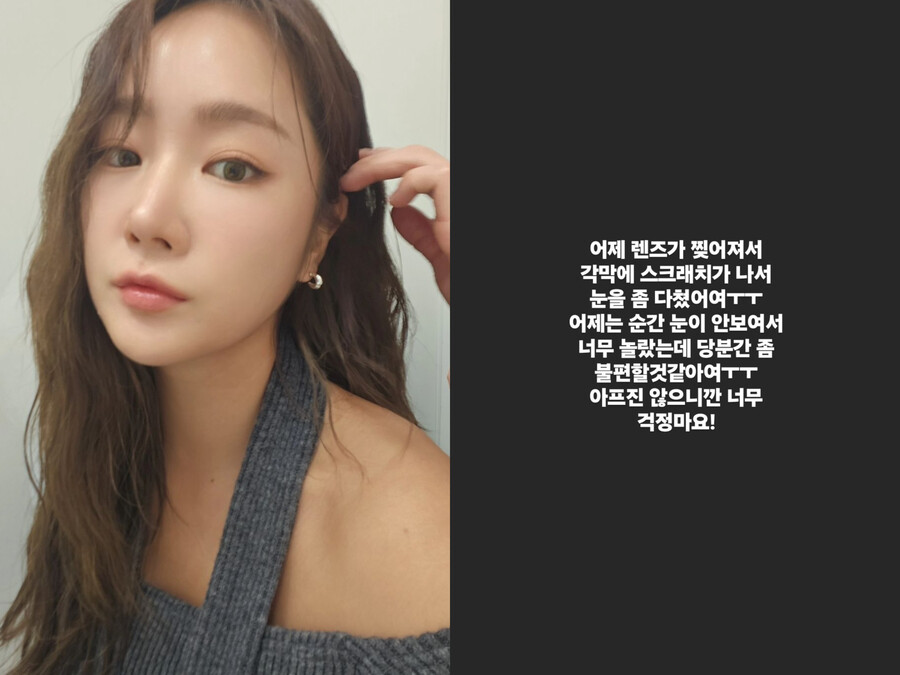 씨스타 소유, 부상에 '철렁' "각막 스크래치, 순간 눈 안 보여"