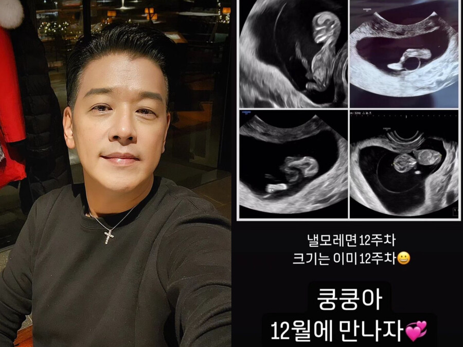 '19세 연하♥' 류시원, 2세 임신+초음파 공개 "쿵쿵아, 12월에 만나자"