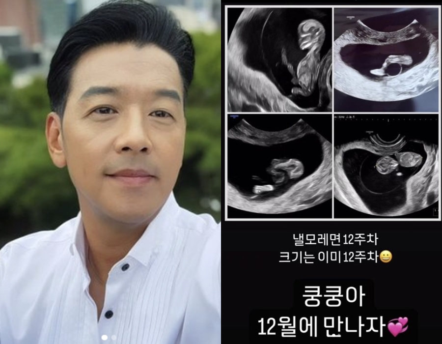 류시원, '♥19세 연하 재혼' 4년 만에 아빠 된다…"최고의 선물, 사랑해"