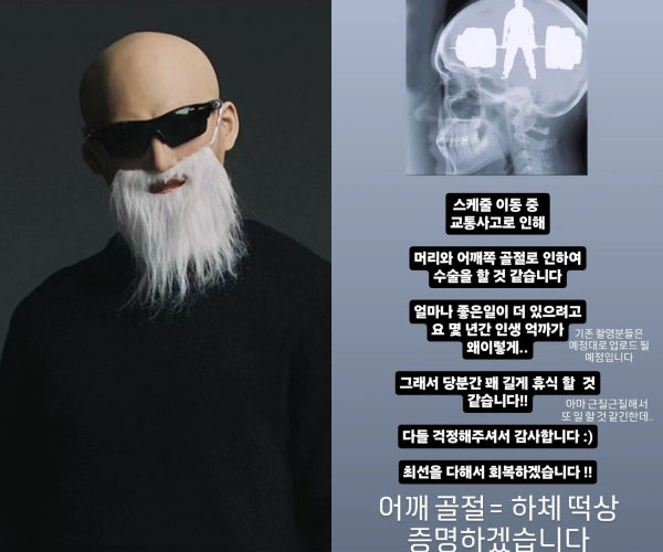 김계란, 교통사고로 머리·어깨 골절 "활동 중단 중에도 하체 떡상 증명"[전문]