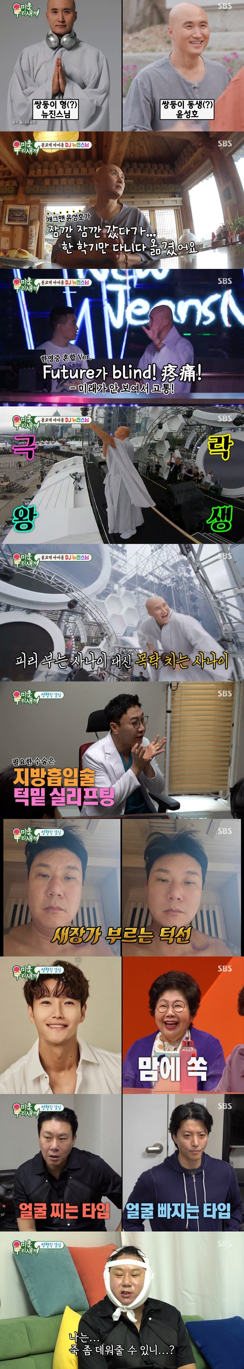 이상민, 방송 중 실제 성형수술 받아…얼굴에 붕대 감고 등장('미우새')