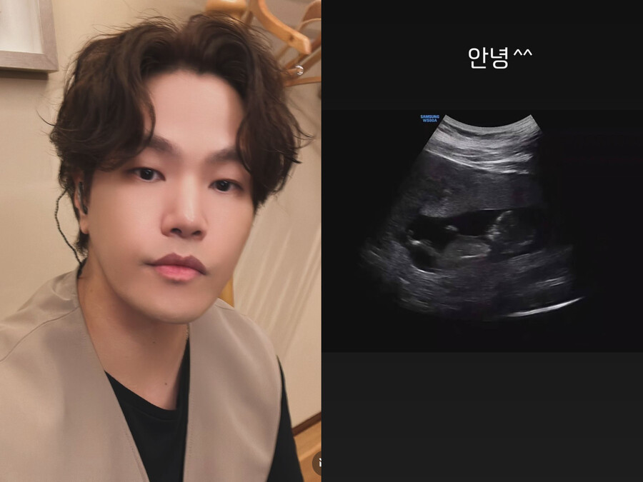 ▲ 출처| 나윤권 인스타그램