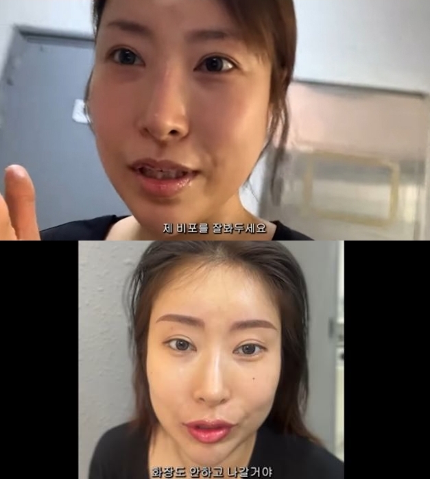 '성형 대명사' 이세영, 이번엔 '얼굴 전체 화장' 시술..비포&애프터 '깜놀'