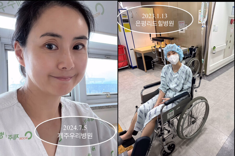'싱글맘' 최정윤, 십자인대 파열 수술 "기적과도 같은 감사한 일"