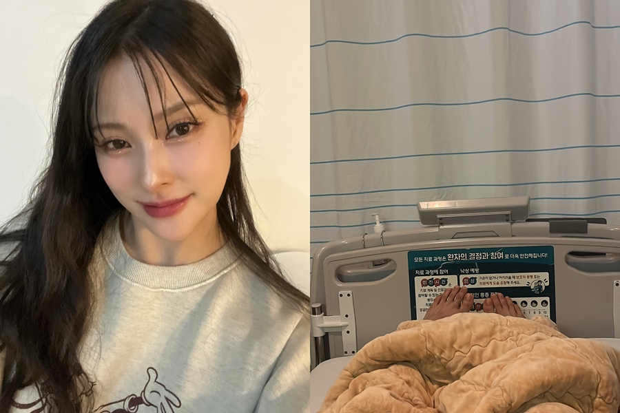 카라 박규리, 16일 광대+안와 골절 수술 받는다…"기도해줘요"