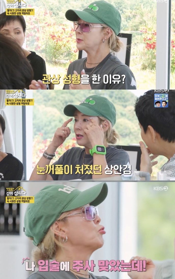 "아픔 겪고 초라해지기 싫었다" 이상아, 관상 성형 고백…입술 주사, 상안검 수술('같이 삽시다')