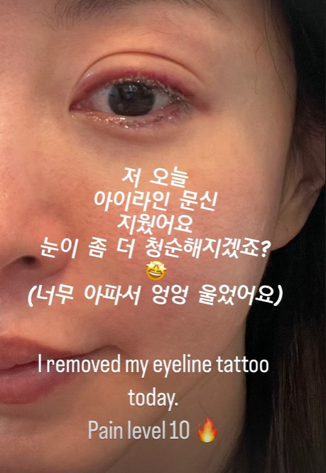 한예슬, 결혼 앞두고 문신 지웠다 "너무 아파서 엉엉 울어"