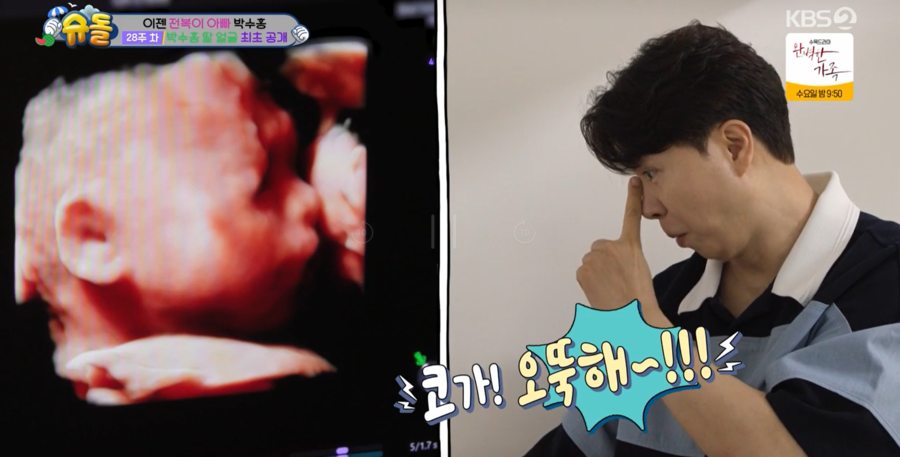 ▲ 사진 | 슈퍼맨이 돌아왔다 방송화면