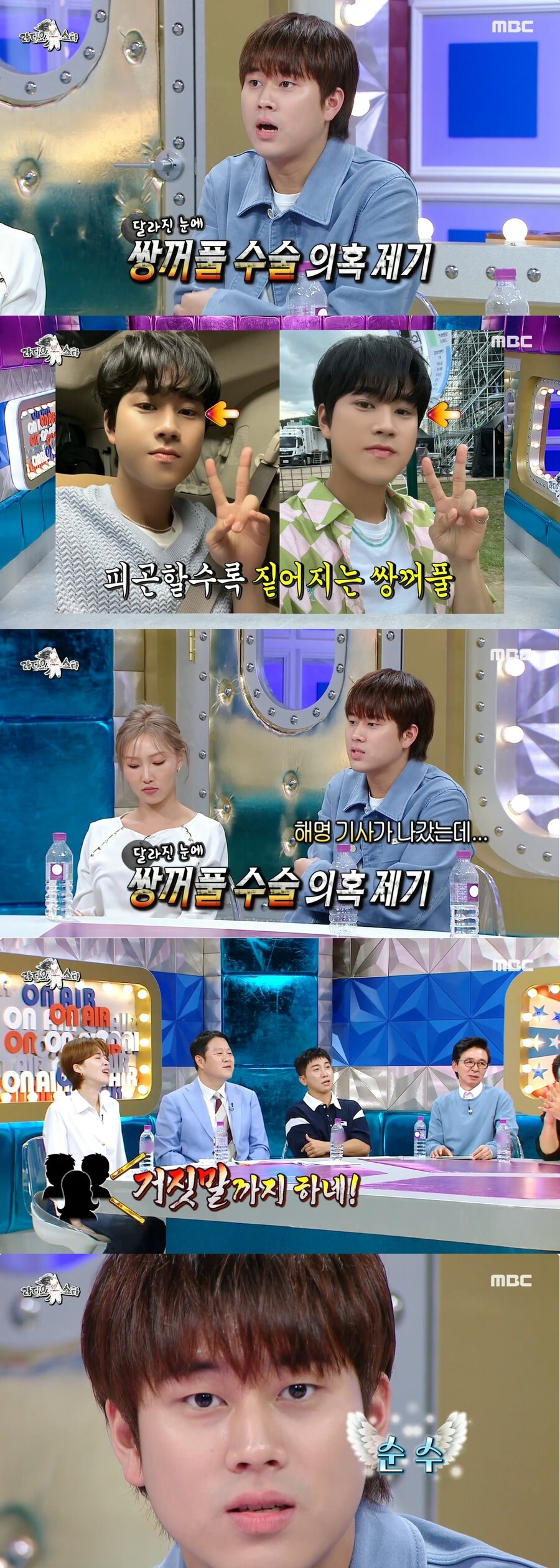 이무진 '쌍수의혹' 재해명 "피곤하면 쌍꺼풀 3~4개"