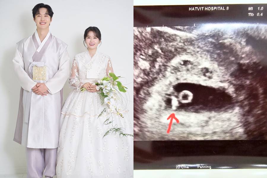 "천사 찾아와" 원혁♥이수민, 결혼 5개월 만에 임신…초음파 사진 공개 