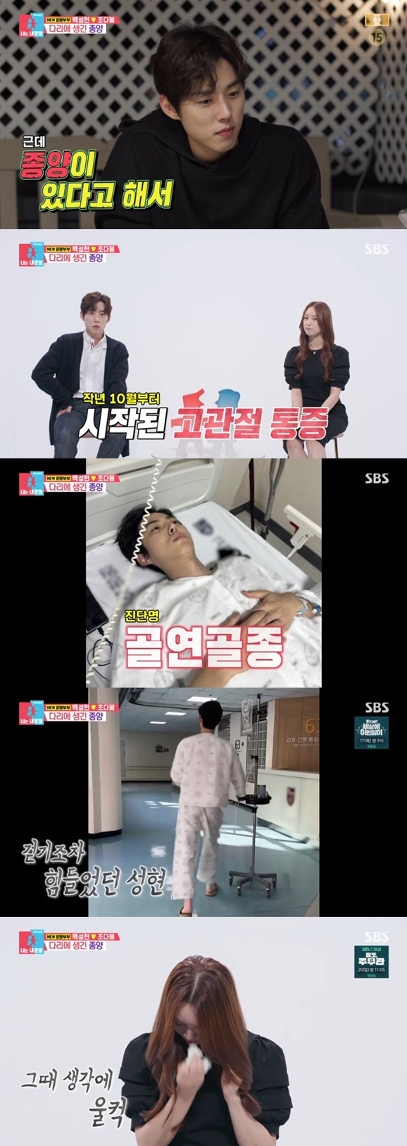 백성현, '다리 종양' 수술 충격 고백 "몸 뒤틀리고 다리 길이 9cm 차이 나"('동상이몽2')[종합]