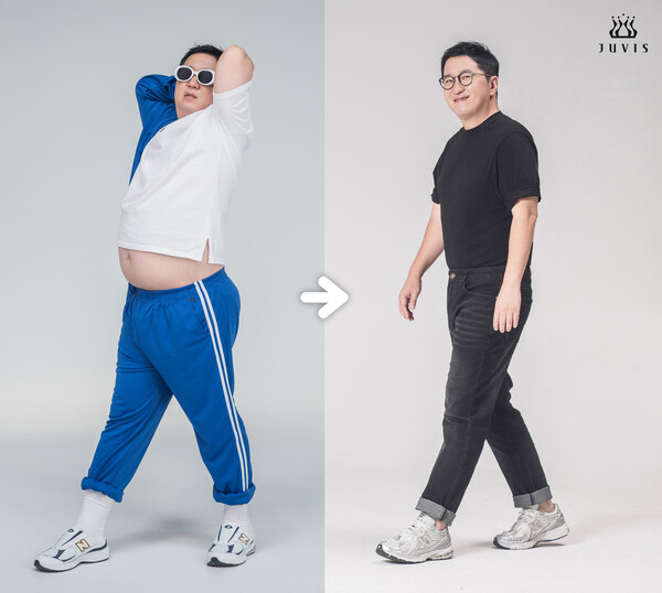 정형돈, 10kg 감량하고 새 사람 됐다 "보조개·울대뼈가 보인다"