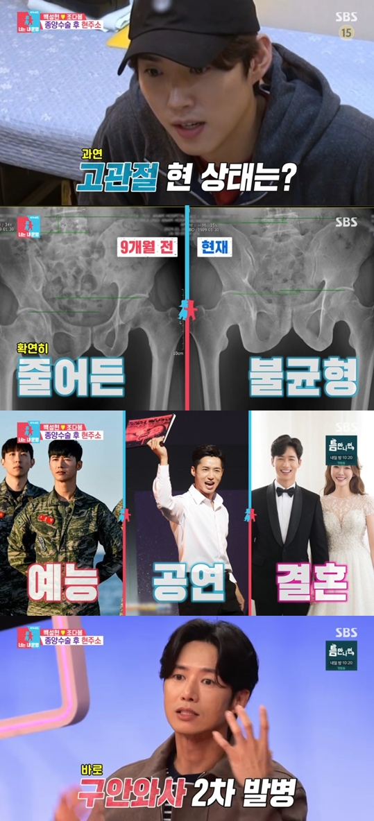 '골연골증' 백성현 "골반 틀어짐 많이 나아"→오종혁 "구안와사로 얼굴 2번 무너져"('동상이몽2')