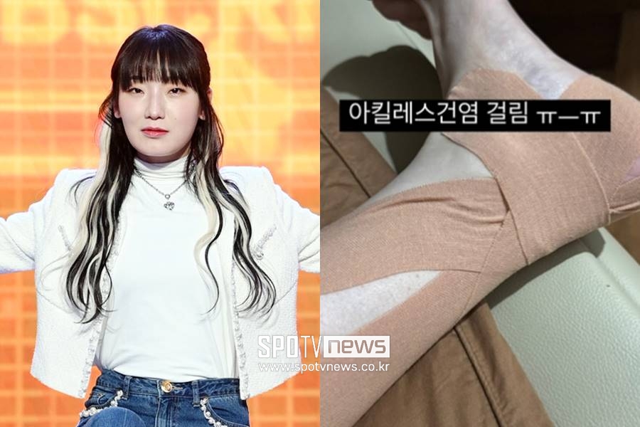 '166만 먹방 유튜버' 히밥, 건강 이상 고백 "아킬레스건염 걸려"