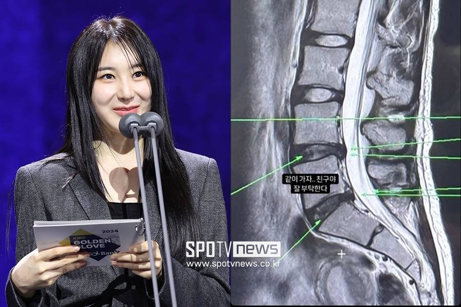 ▲ 이채연. ⓒ곽혜미 기자, 이채연 SNS