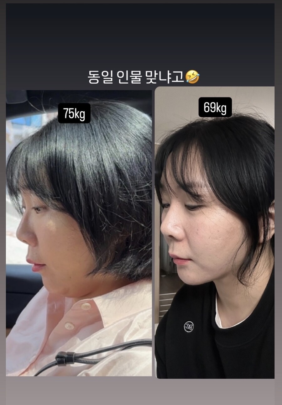 "동일 인물 맞냐고" 허안나, 6kg 감량 전후 사진 공개