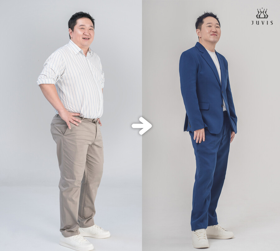 ▲ 정형돈. 제공| 쥬비스