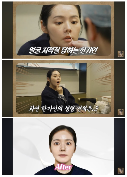 '대한민국 대표미녀' 한가인, 성형외과 견적 받았다 "차 한대 값"('자유부인')