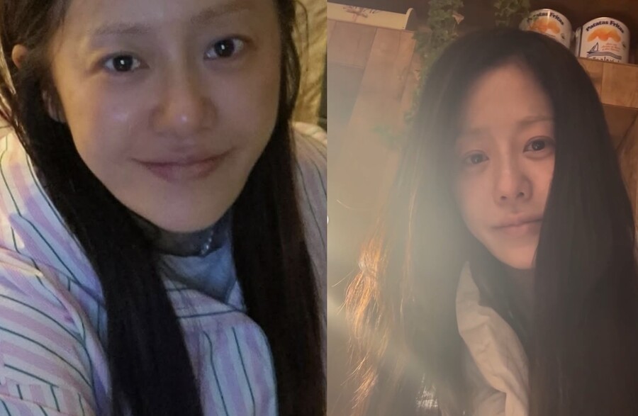 고현정, 수술 후 건강 밝힌 민낯 공개…하정우 화답