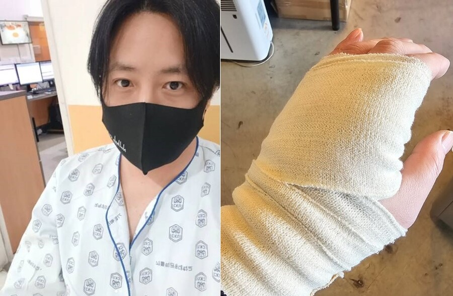 '카페 CEO' 노유민, 아찔한 사고..'찢어진 손'에 팬들 걱정↑