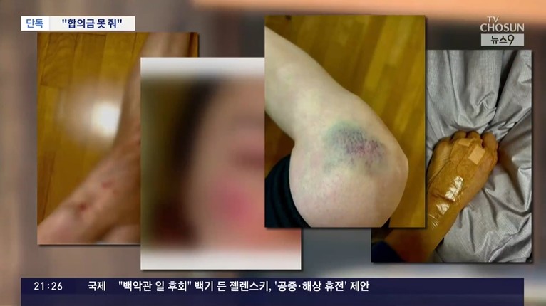 ▲ 출처|TV조선 캡처