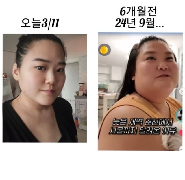 '미나 시누이' 수지, 57kg 감량 '비포&애프터'..이렇게 예뻤나 '턱선 대박'