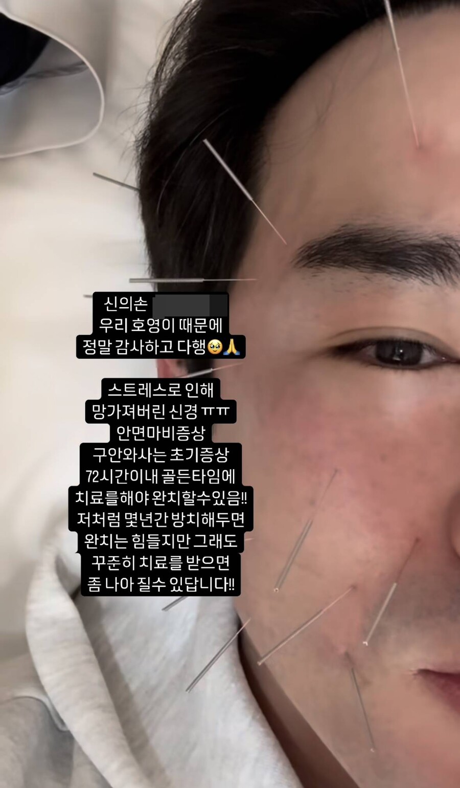 ▲ 이민우. 출처| 이민우 SNS