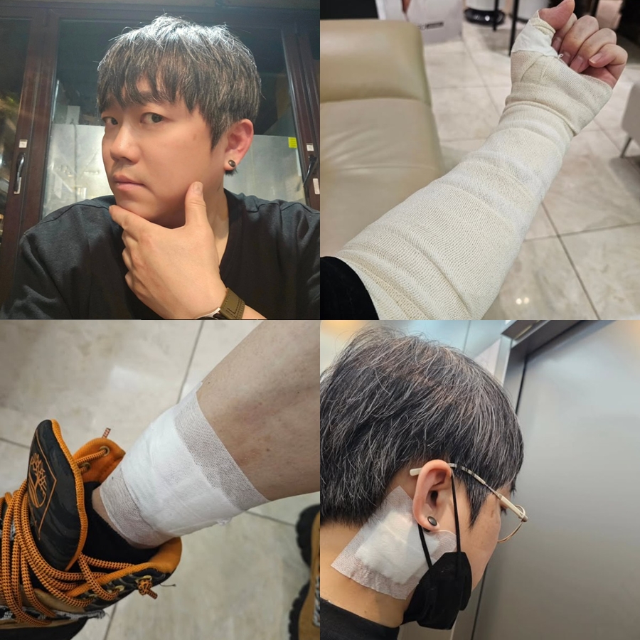 원타임 송백경 "타투=마지막 연예인병 흔적, 3년 동안 지울 것"[전문]