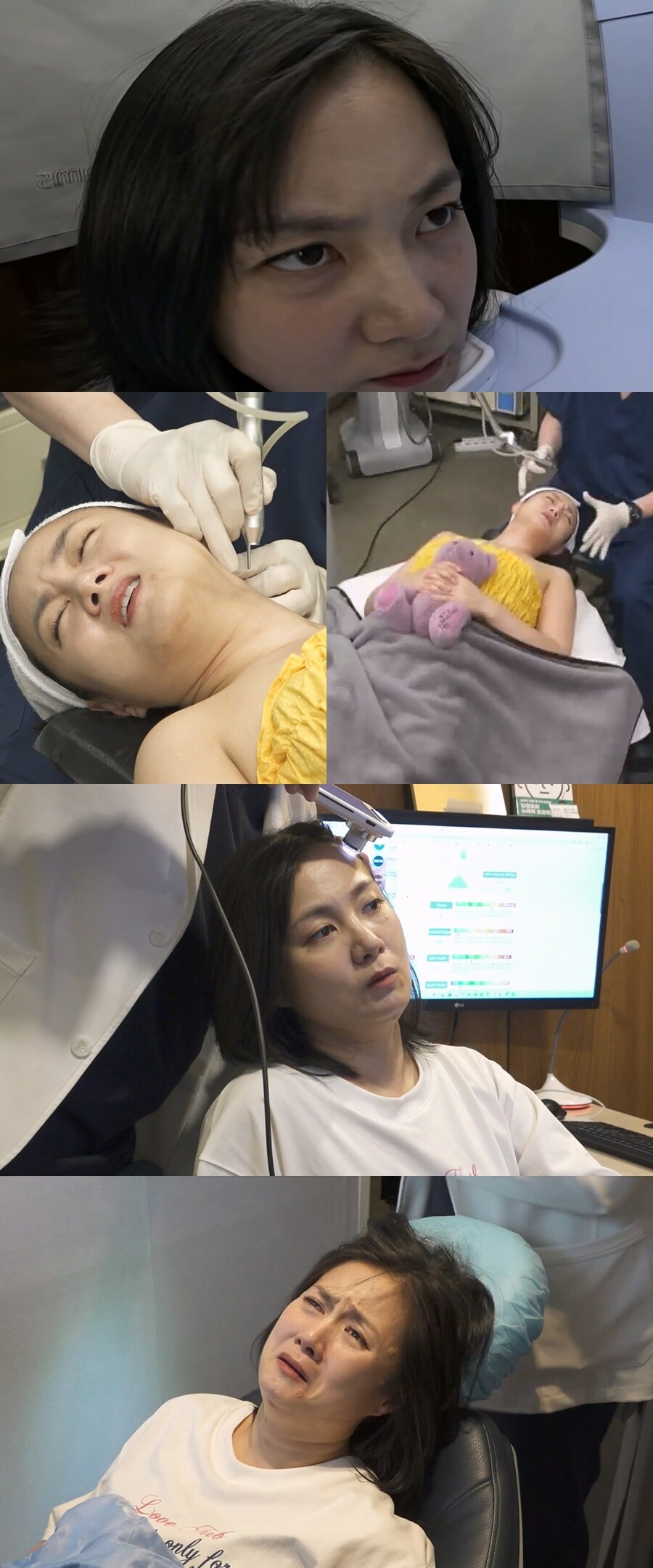 박나래, 탈모 고민 있었다 "수치스러워, 인정하기까지 시간 걸려"('나혼산')