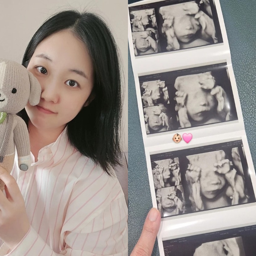 '아들상' 박보미, 둘째는 딸 "여동생 확정…넘나 설레잖아"