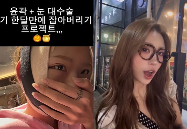 故최진실 딸 최준희, 또 성형 "윤곽+눈 大수술"→김송 "내가 광대 선배"