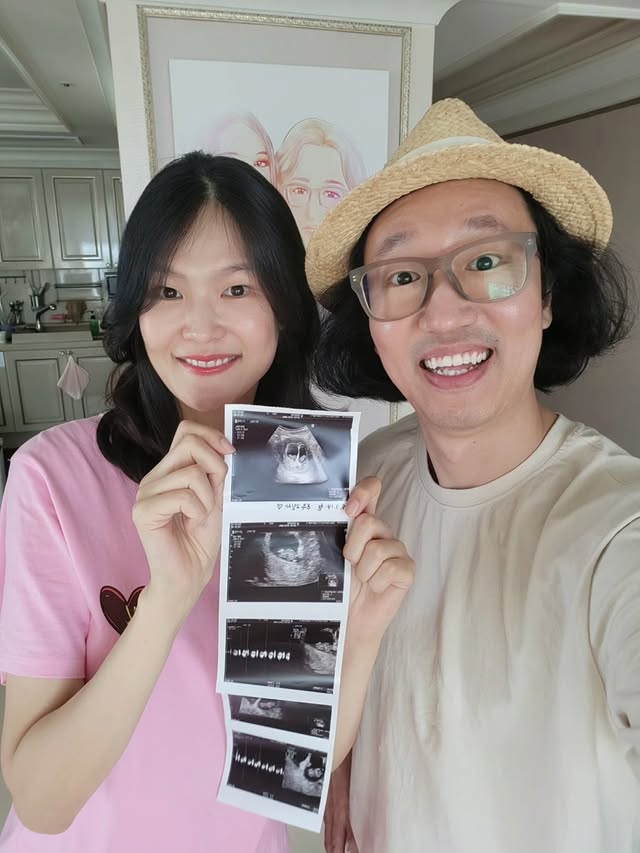 김경진♥전수민, 난임 극복하고 쌍둥이 임신 "함께 축복해주세요"
