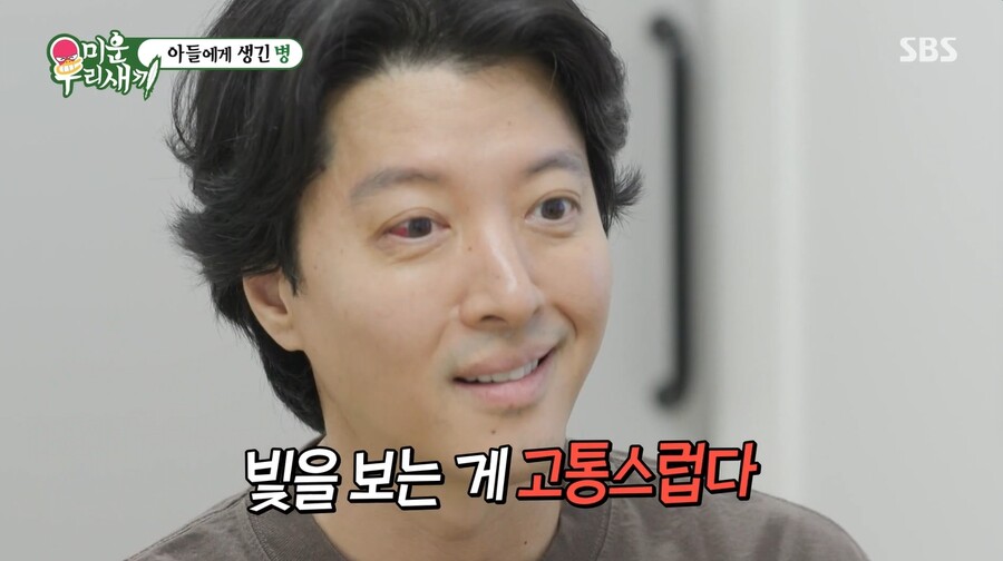 "원인불명 완치불가"…눈 충혈된 이동건, 충격 희귀병 진단 "빛 보는 게 고통"